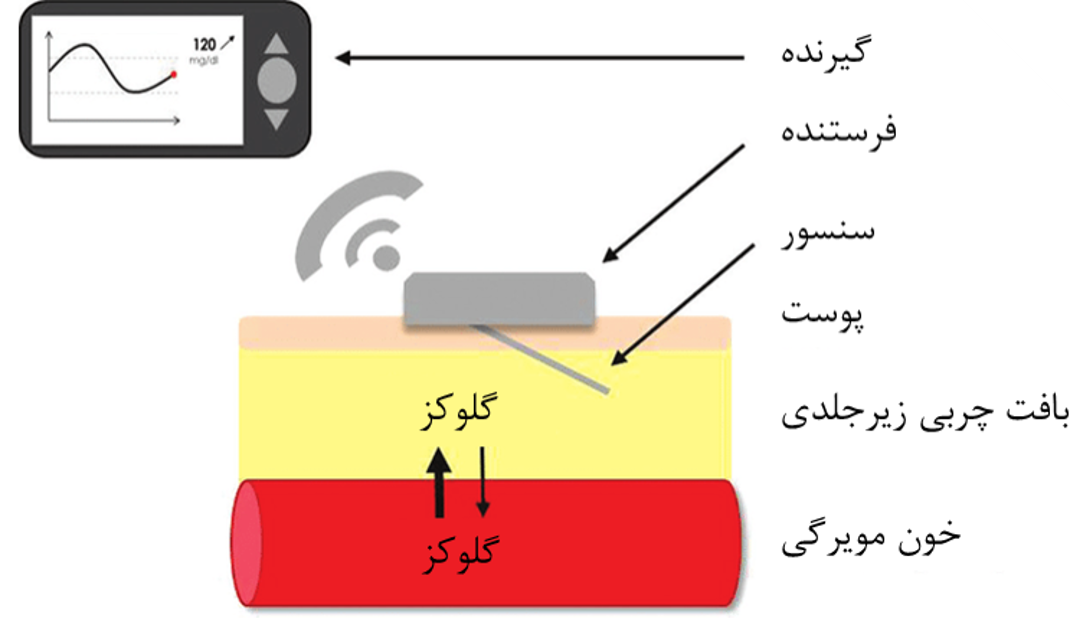 اجزای cgm