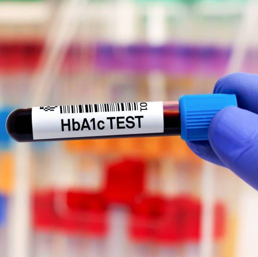 HBA1c چیست؟ هموگلوبین a1c نرمال چند است؟ آزمایش ای وان سی یا قند خون سه ماهه
