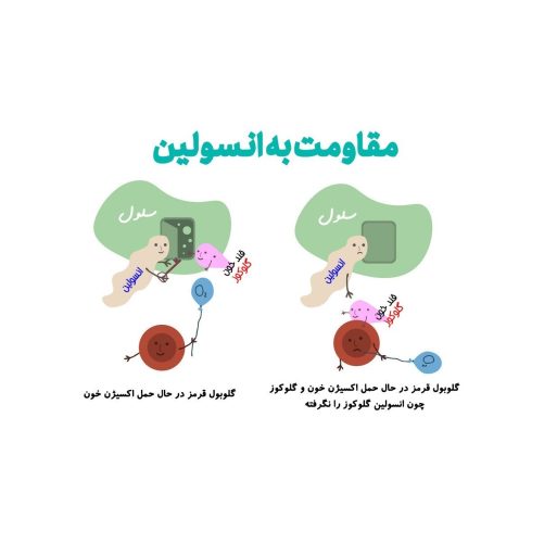 مقاومت به انسولین چیست؟ علت‌ها، علائم و راه‌های درمان مؤثر